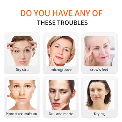 Retinol Renew Anti-Aging Cream – Smooth & Youthful Skin | Euroboutique